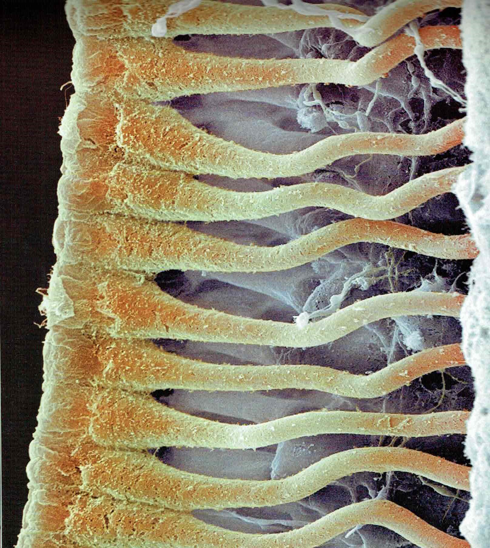 CELLULE COCLEARI [SEM]