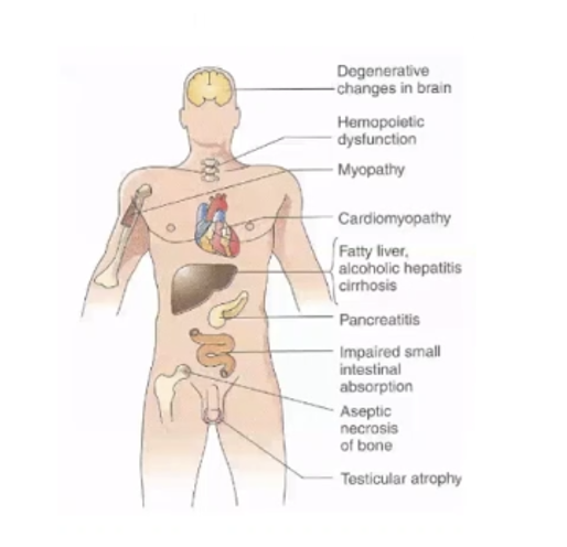 ETANOLO: ALTERAZIONI METABOLICHE
